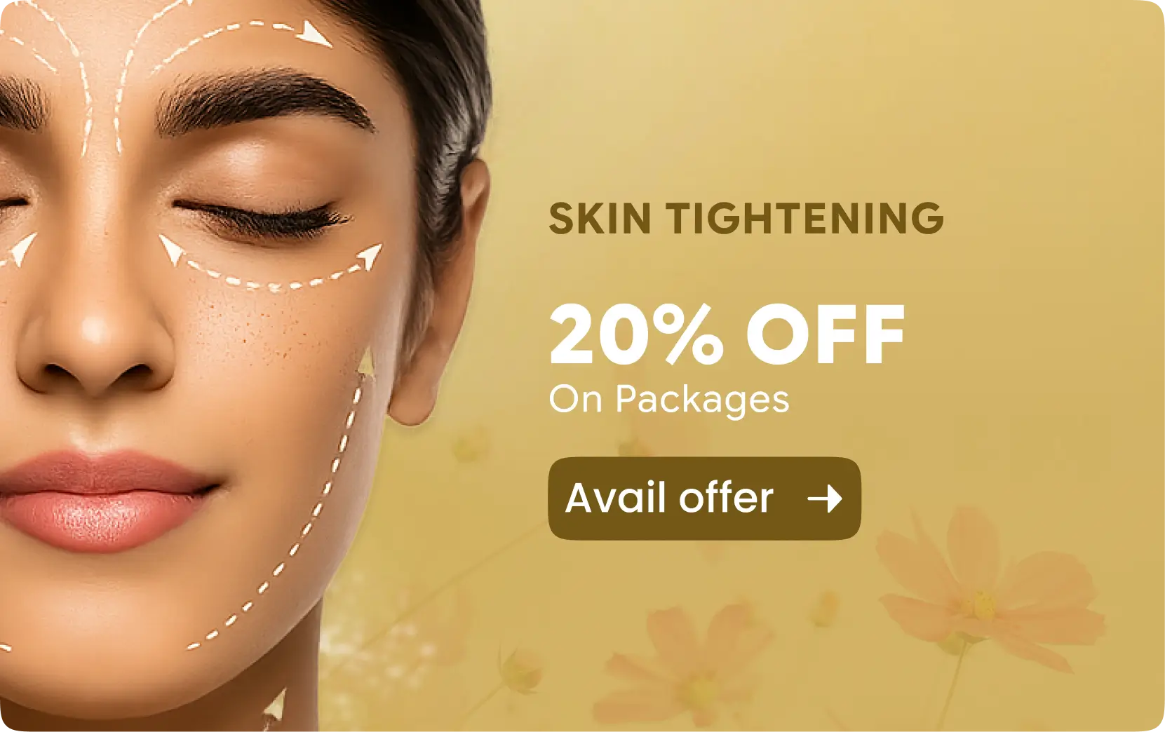 Skin Tightening