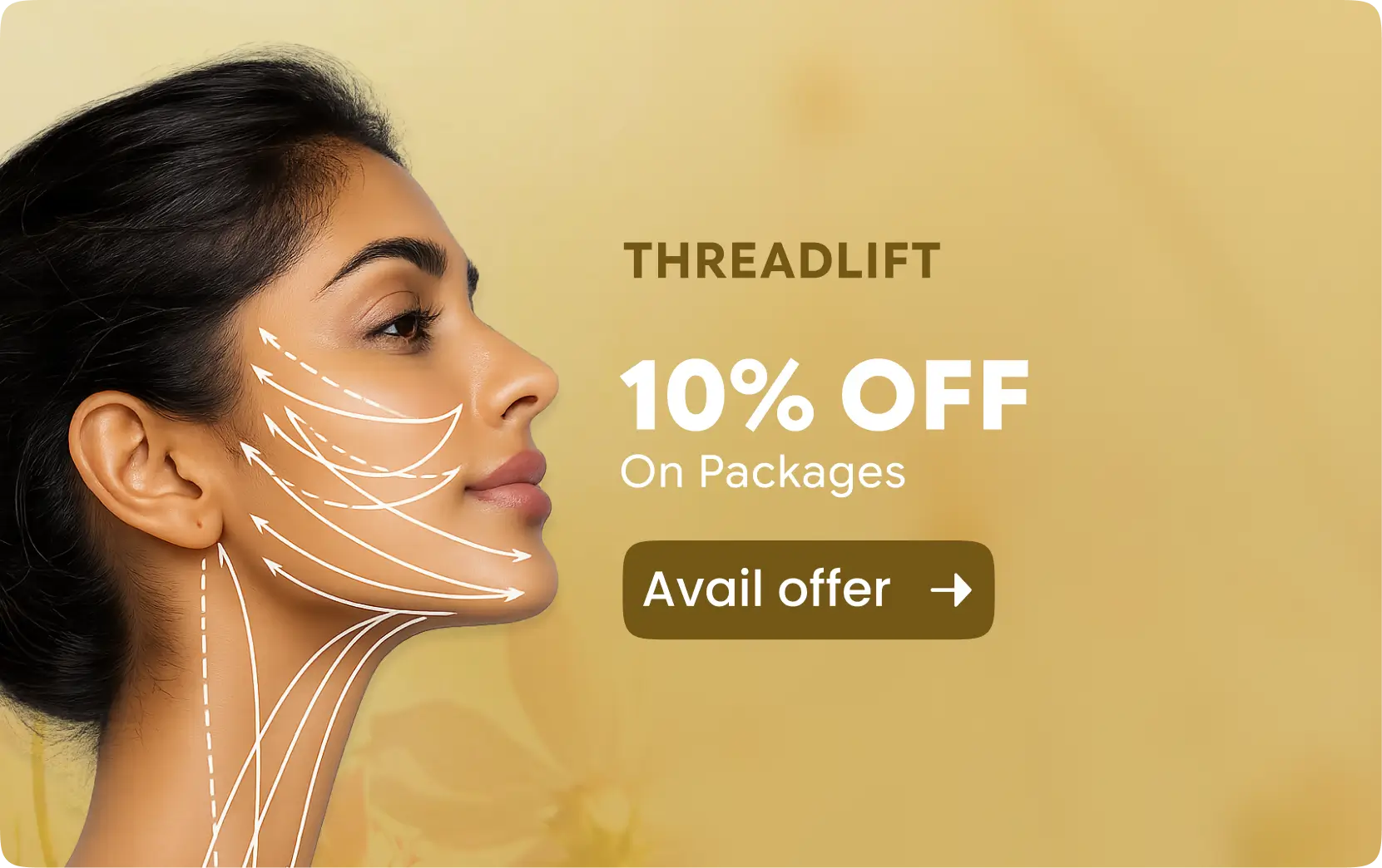 Thread Lift