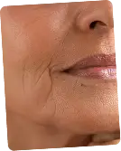 Skin Clinic in Bangalore
